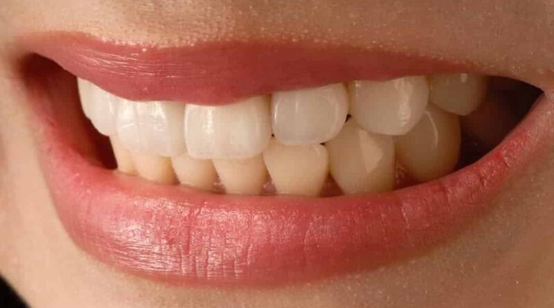 home remedies for oral health