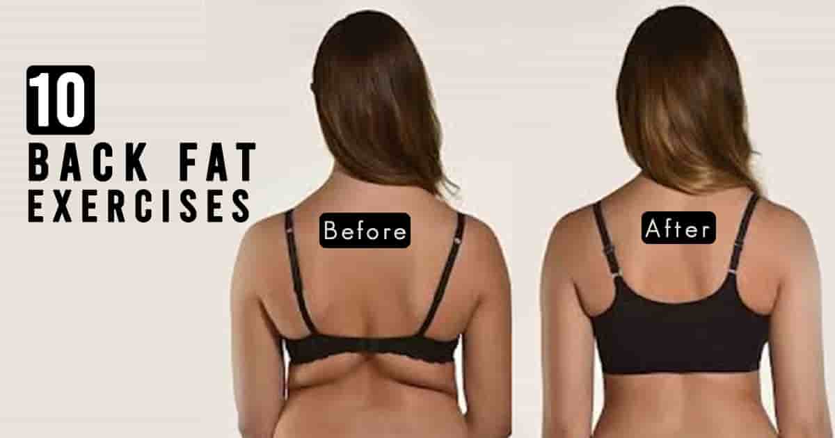 How to Get Rid of Back Fat Naturally and Permanently