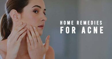 Home Remedies for Acne