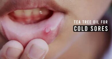 Tea Tree Oil for Cold Sores