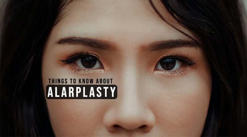 Things to Know About Alarplasty