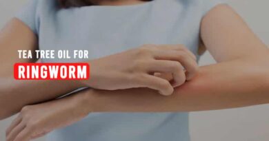 tea tree oil for ringworm