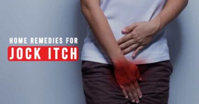Home Remedies for Jock Itch