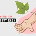 Home Remedies for Poison Ivy Rash