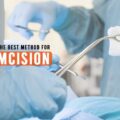 Best Method for Circumcision