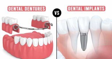 Dental Dentures vs Implants