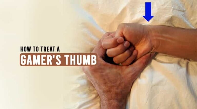 Gamer's Thumb: Causes and Treatments | HealthtoStyle