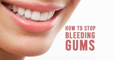 How to Stop Bleeding Gums
