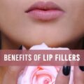 Benefits of Lip Fillers