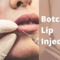 Botched Lip Injections
