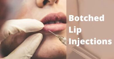 Botched Lip Injections