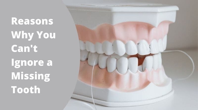 Reasons Why You Can't Ignore a Missing Tooth