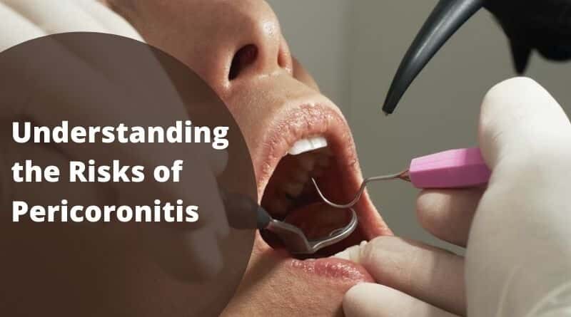 Understanding the Risks of Pericoronitis
