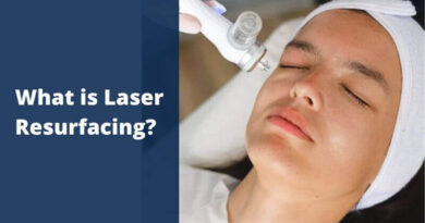 Laser Resurfacing