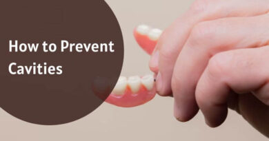 How to Prevent Cavities