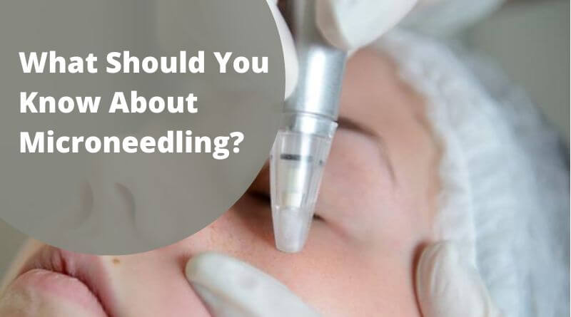 What Should You Know About Microneedling